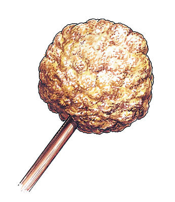 Related Image