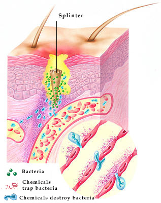 Chemicals and special cells deal with any infection beneath the outer layer of the skin.